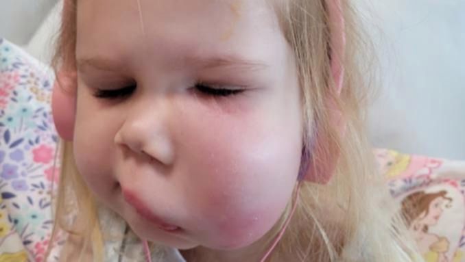 Lilly ma rzadką chorobę