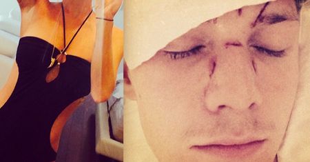 Ochroniarz Lohan POBIŁ brata Paris Hilton?! (FOTO)