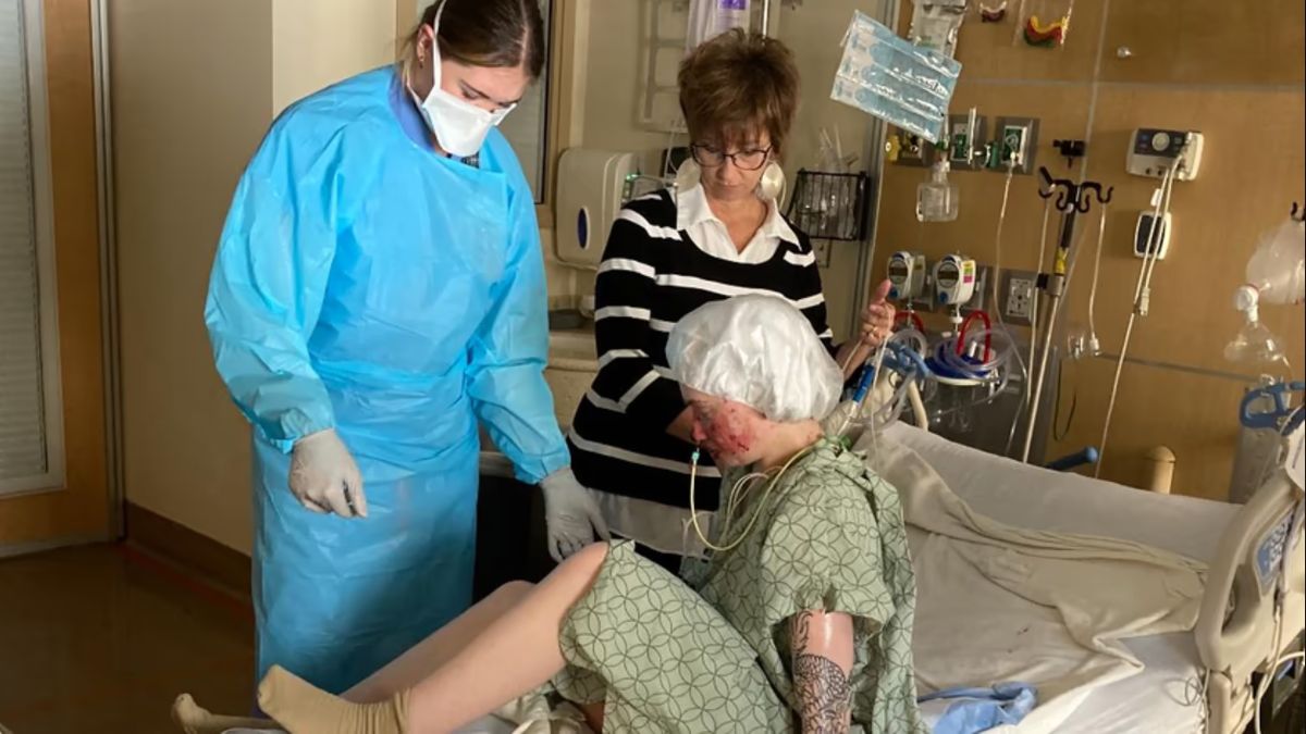 23-latka cierpi z powodu rzadkiego zespołu Stevensa-Johnsona