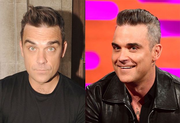 Robbie Williams wyznaje, że ingerował w wygląd: "Nie mogłem, ku*wa, ruszyć czołem!"