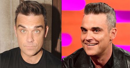 Robbie Williams wyznaje, że ingerował w wygląd: "Nie mogłem, ku*wa, ruszyć czołem!"