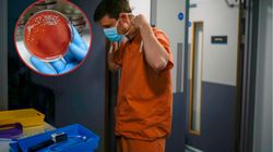 Szczecin: U zmarłego pacjenta wykryto groźną bakterię. Zapomniana choroba powraca?