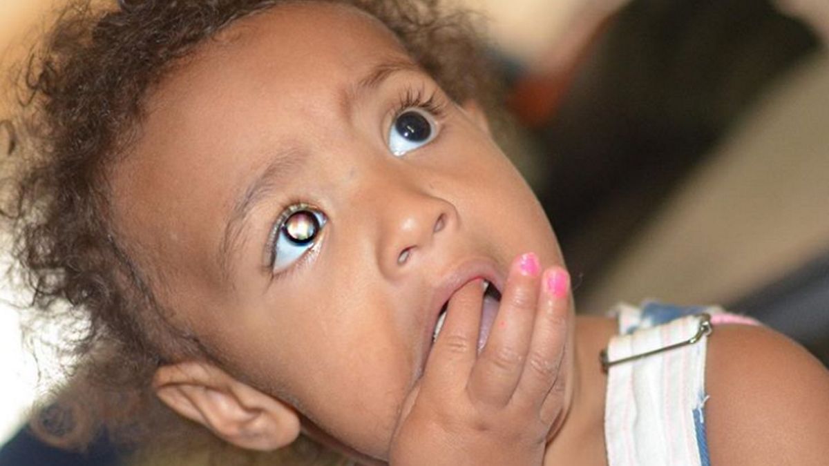 Dziewczynka miała plamę w oku