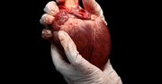 Przeszczep serca - co to jest, wskazania, przeciwwskazania, powikłania