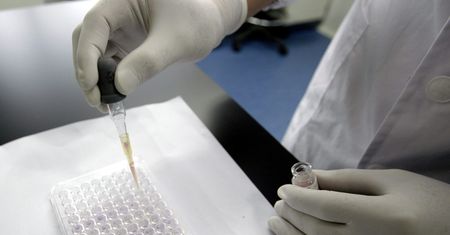 Rośnie liczba zakażeń HIV. "To wina wpływów Rosji"