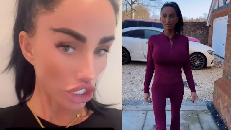 Coraz szczuplejsza Katie Price zapowiada kolejny zabieg