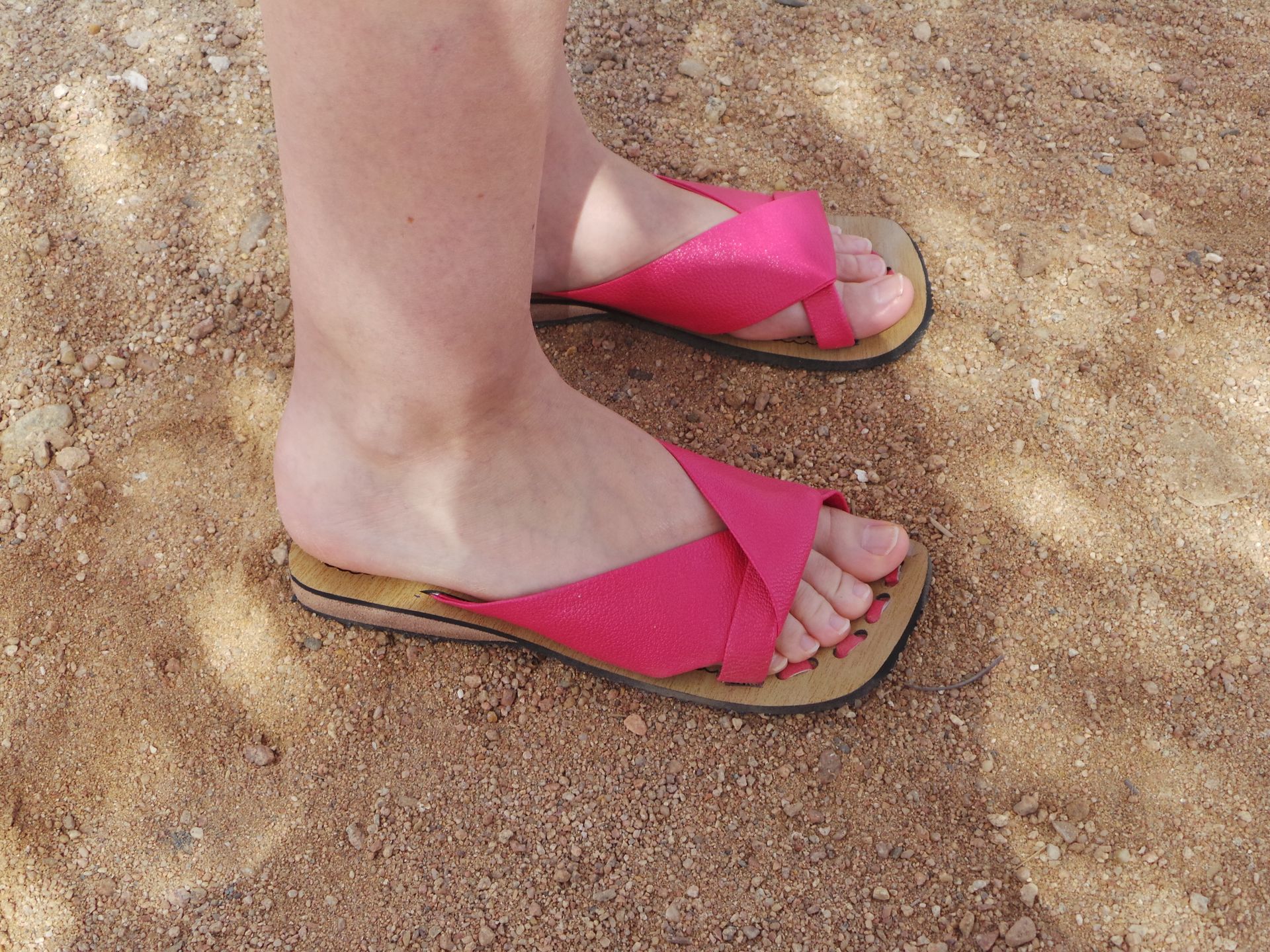 Podiatrist Warns: Flip-Flops and Sandals in the Heat Can Seriously Damage Your Feet