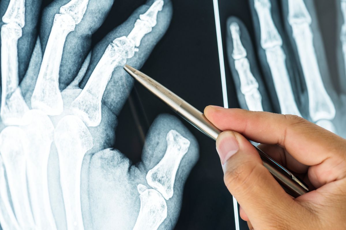 The new X-ray sensor offers clearer images with less radiation