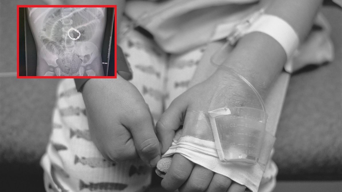 Nie żyje 8-latek. Połknął kulki magnetyczne