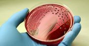 Salmonella to groźna bakteria nie tylko z żywności. Zobacz, jakie są objawy zatrucia Salmonellą, jak uniknąć zakażenia oraz jak je leczyć