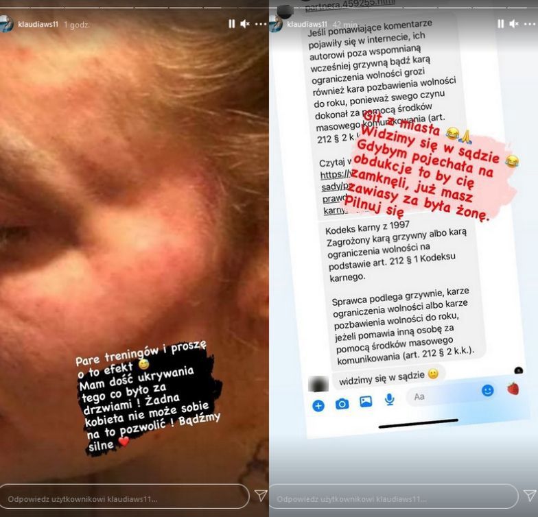 Klaudia Stec z "Warsaw Shore" została pobita przez byłego partnera?