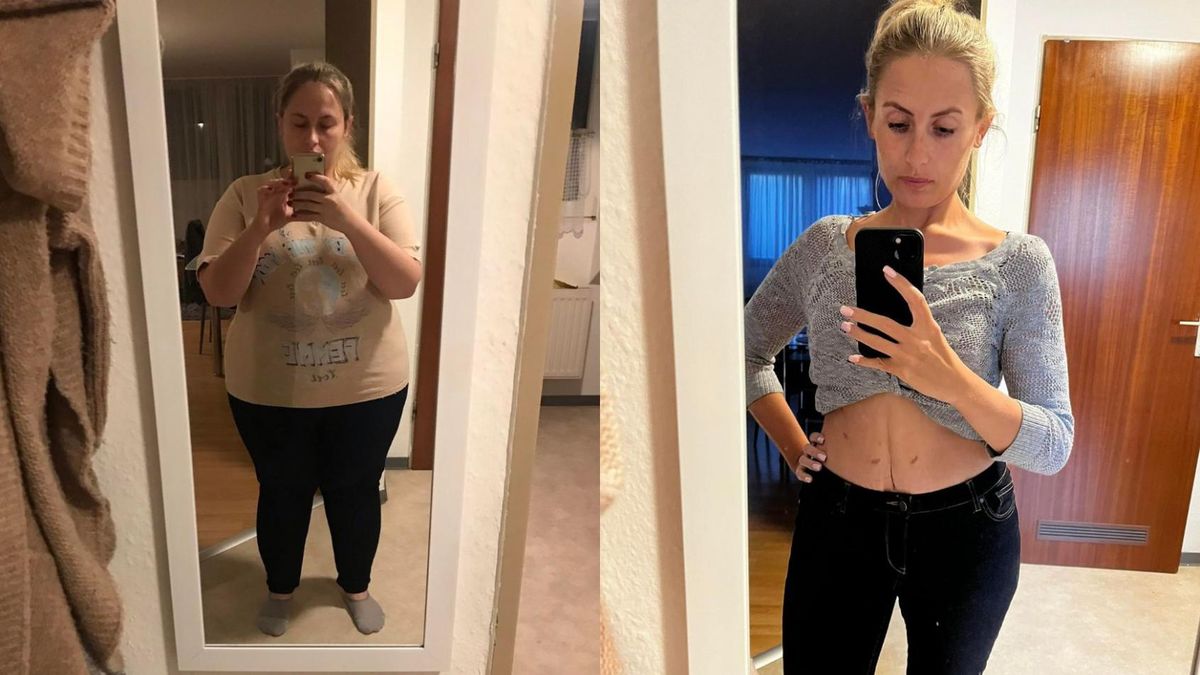 Czy operacje bariatryczne dają efekty? Tak zmieniło się jej ciało w ciągu roku od zabiegu