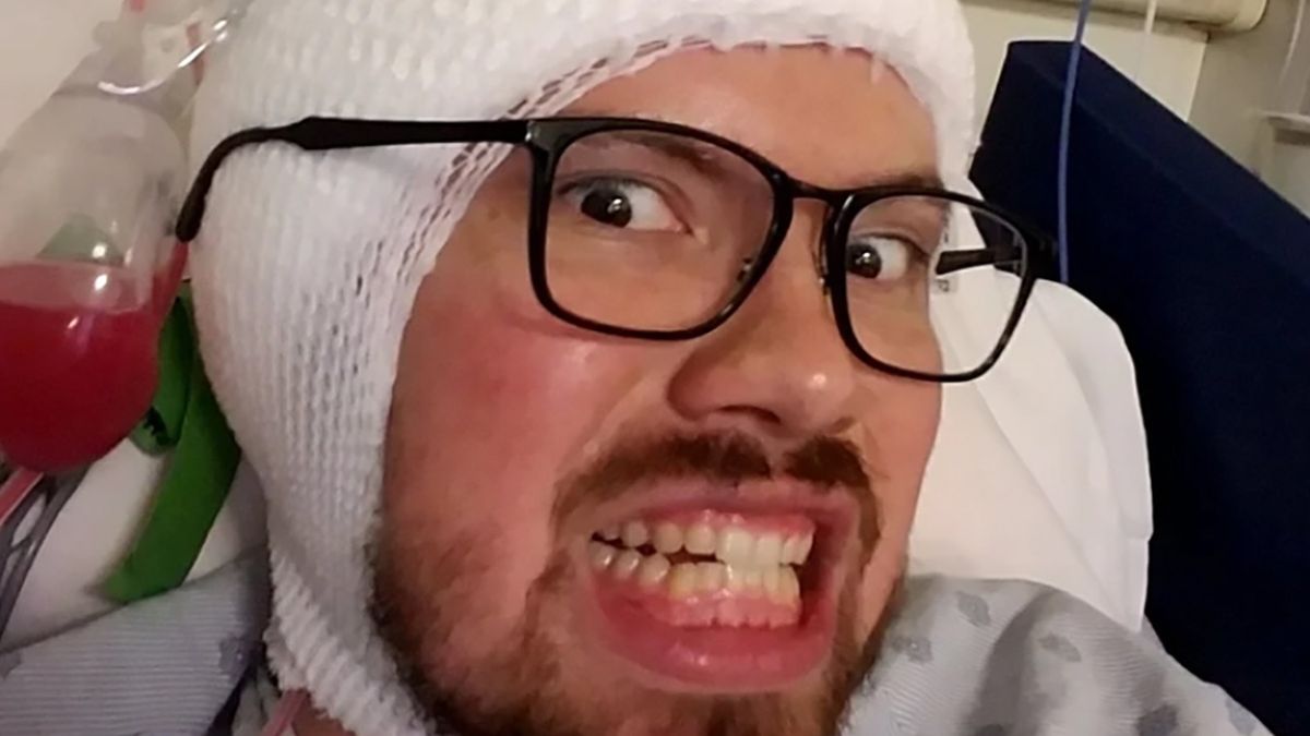 Mężczyzna przeszedł operację mózgu. Usunięto mu ośrodek odpowiedzialny za strach