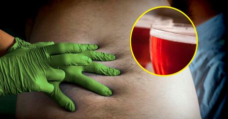 Pijasz codziennie? Ryzyko raka jelita grubego drastycznie wzrasta