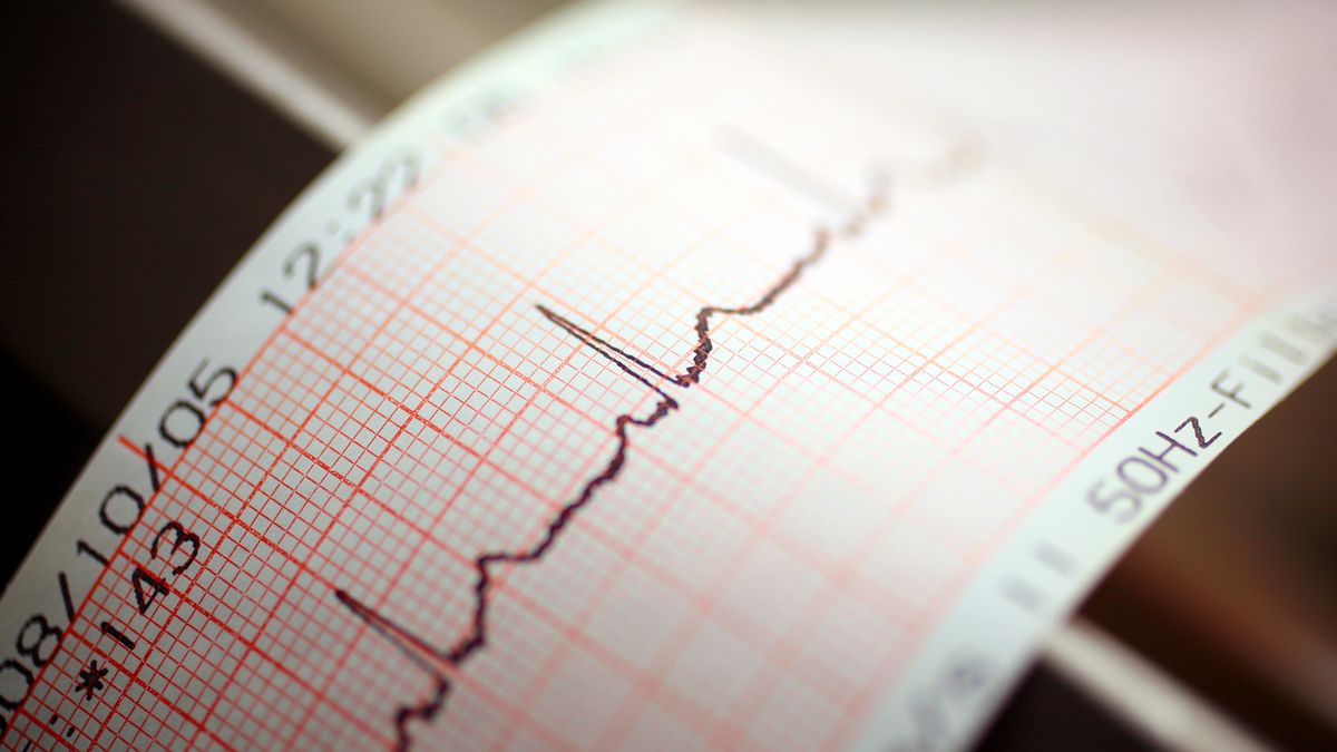 EKG - zdjęcie ilustracyjne.
