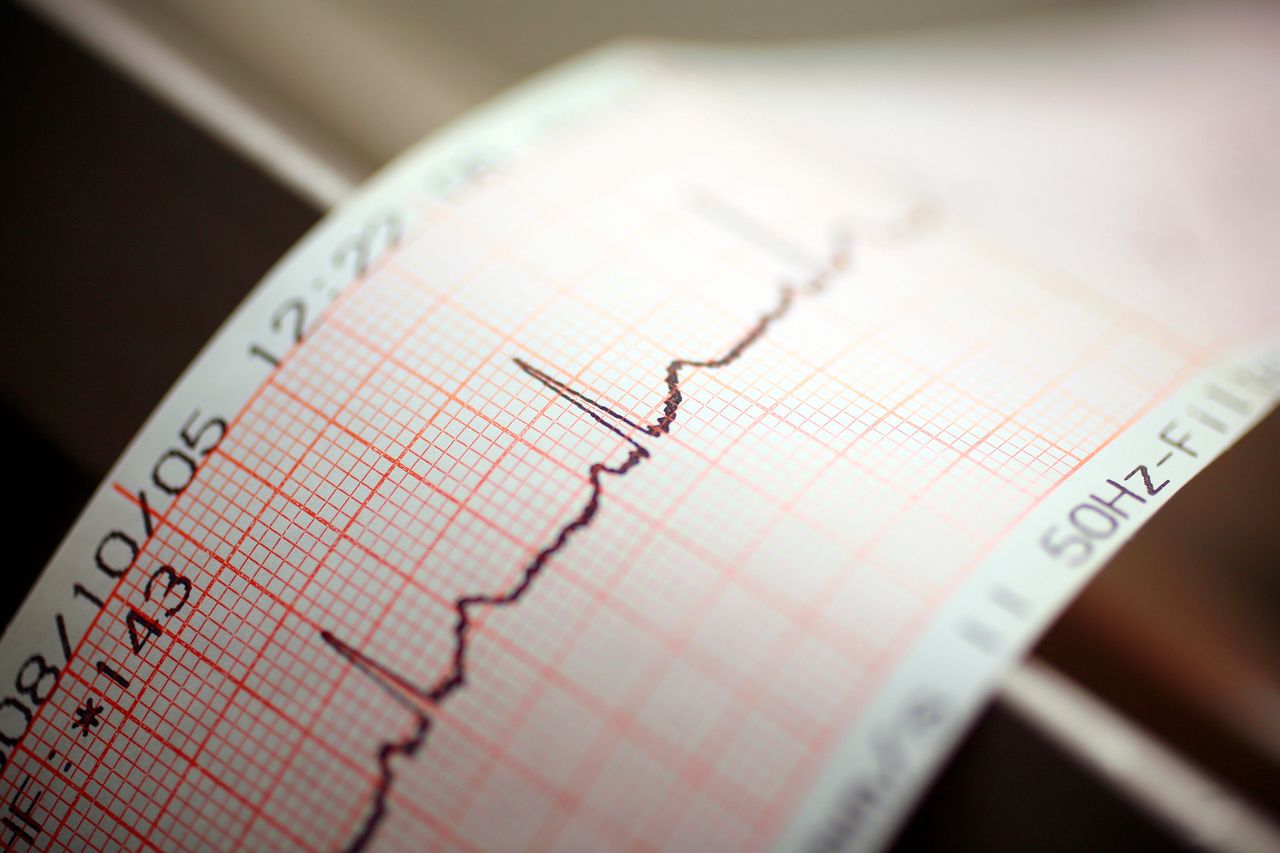 Sztuczna inteligencja wesprze lekarzy. AI "nakarmione" danymi z EKG