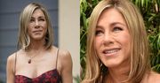 Co się stało z twarzą Jennifer Aniston? Lekarz alarmuje o ŹLE wykonanym zabiegu (WIDEO)