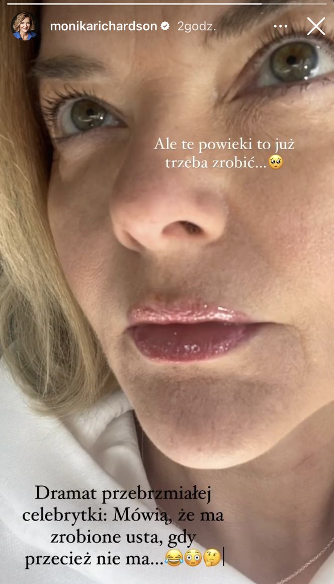 Monika Richardson rozważa operację plastyczną