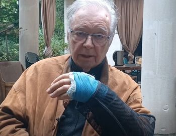 Zanussi miał wypadek na planie. Upadł z żelaznych schodów i złamał kość czaszki