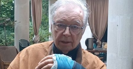 Zanussi miał wypadek na planie. Upadł z żelaznych schodów i złamał kość czaszki