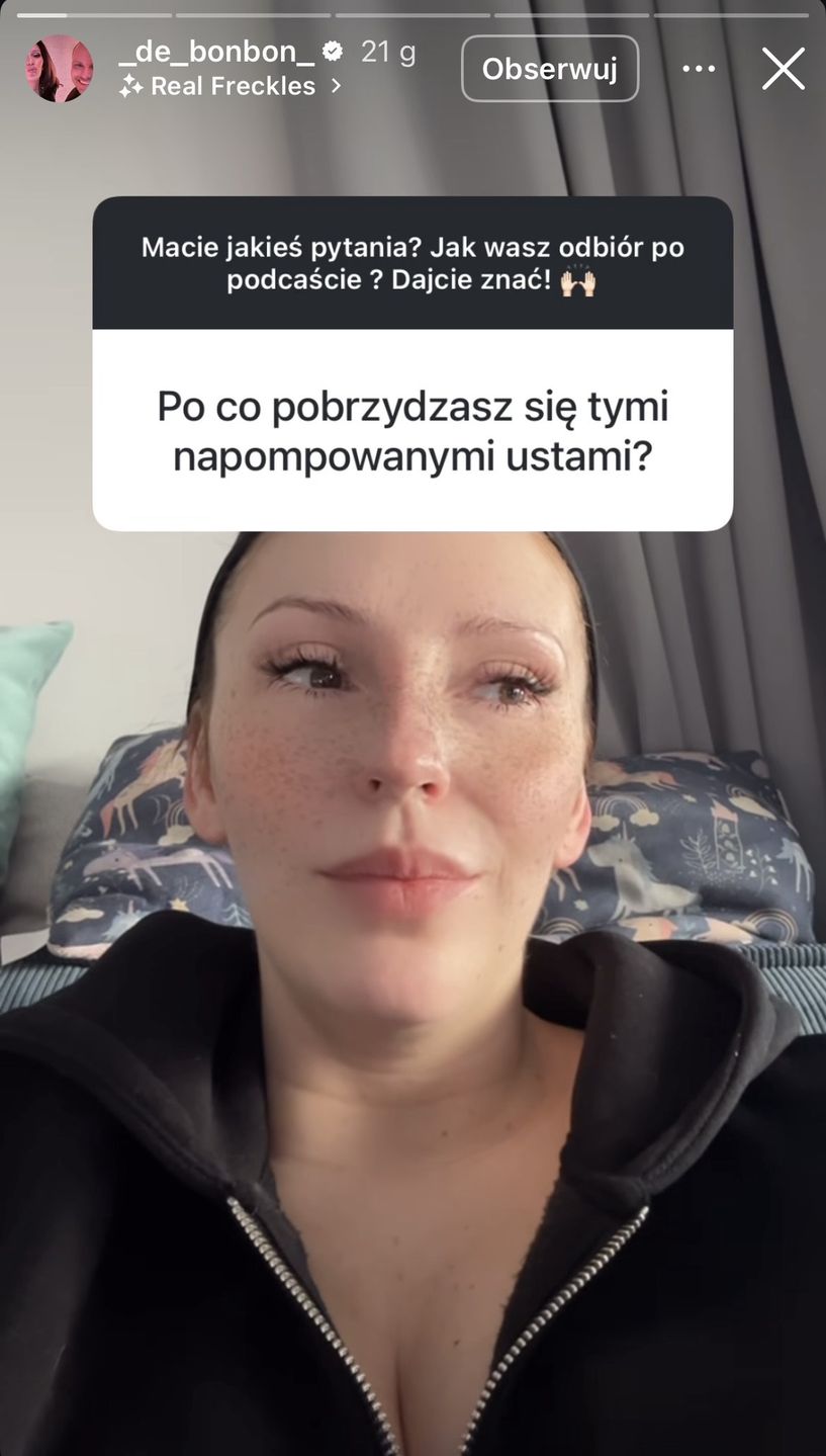 Dominika Serowska zaprzecza, że powiększyła usta 