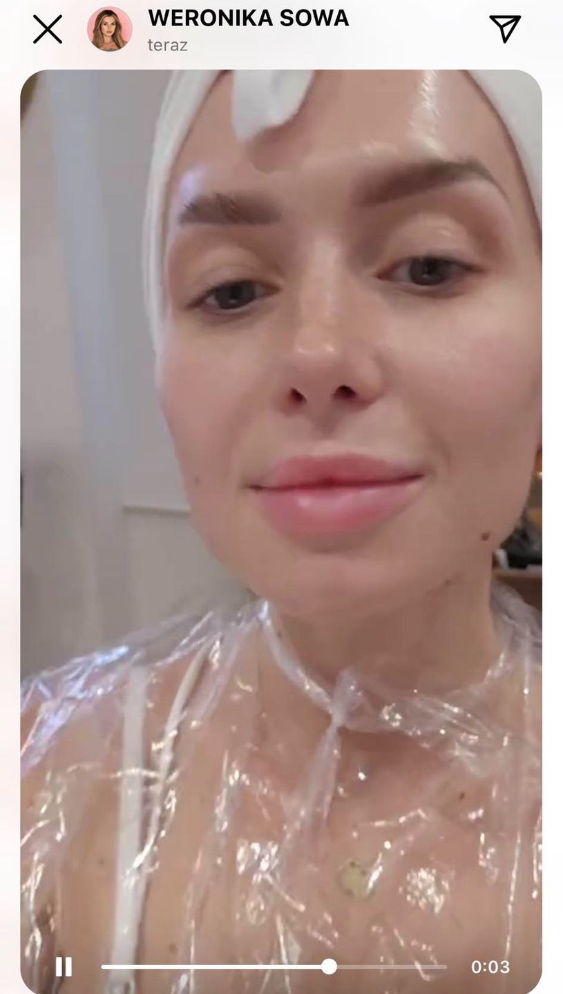 Wersow rozpuściła kwas w ustach