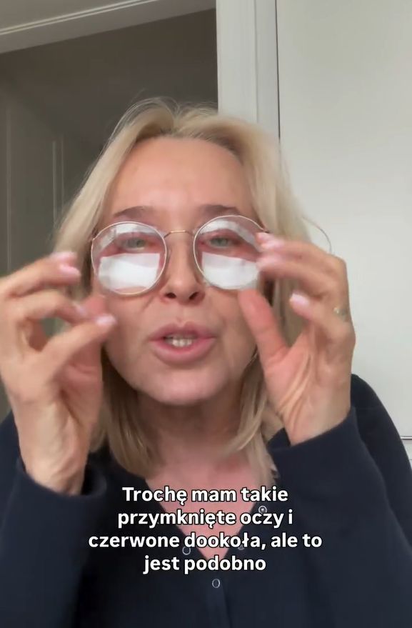 Agata Młynarska zrobiła operację powiek