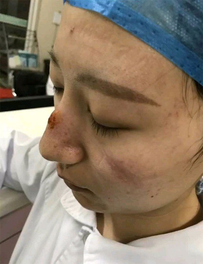Lekarze i pielęgniarki po dyżurach. Te selfie pokazują twarze prawdziwych bohaterów 14