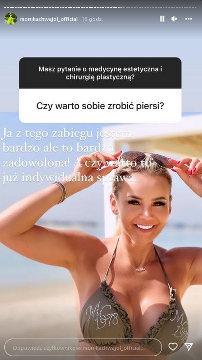 Monika Chwajoł pokazała stare zdjęcia i opowiedziała o operacjach