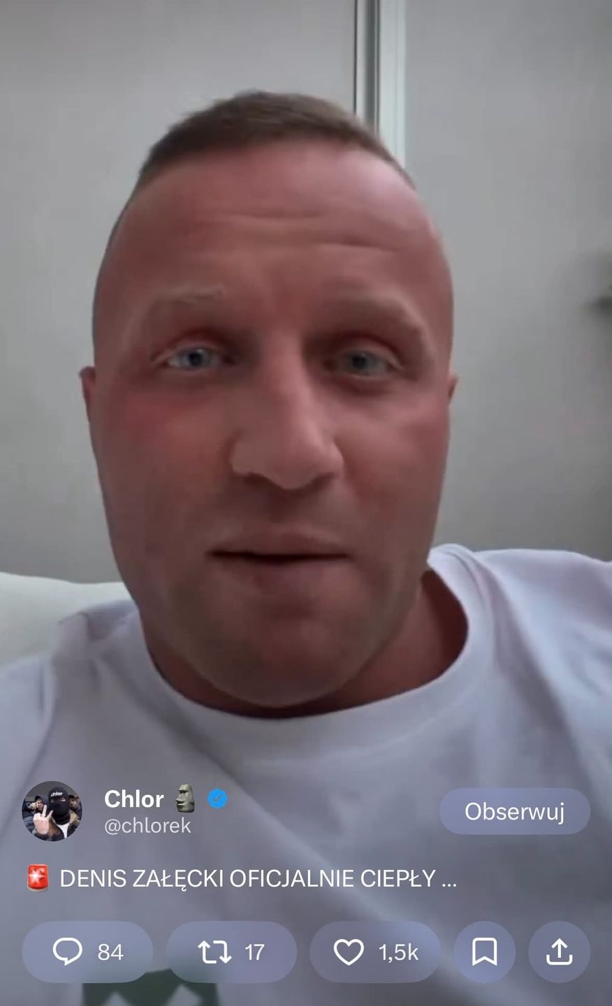 Denis Załęcki operacyjnie rozjaśnił sobie oczy