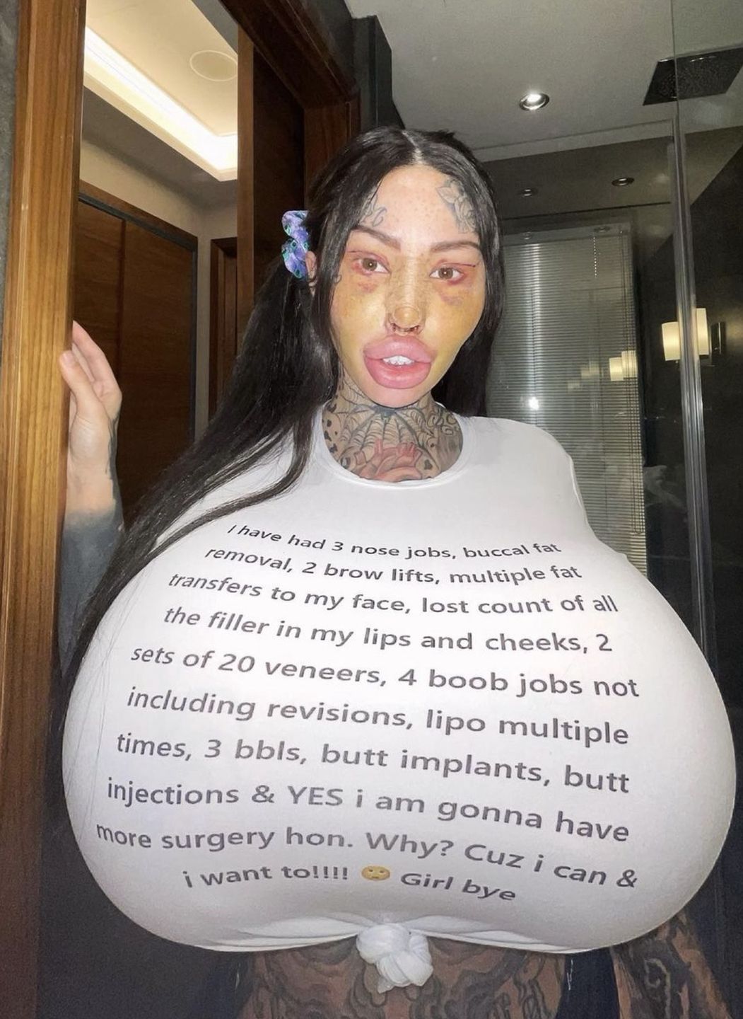 Uzależniona od operacji influencerka Maria Magdalena chwali się metamorfozą i dumnie ogłasza, że ma "najgrubszą pochwę na świecie"