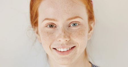 Heterochromia – charakterystyka, występowanie, diagnostyka
