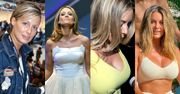 Małgorzata Rozenek ZMNIEJSZA IMPLANTY! Przypominamy spektakularną metamorfozę jej perfekcyjnego BIUSTU (STARE ZDJĘCIA)
