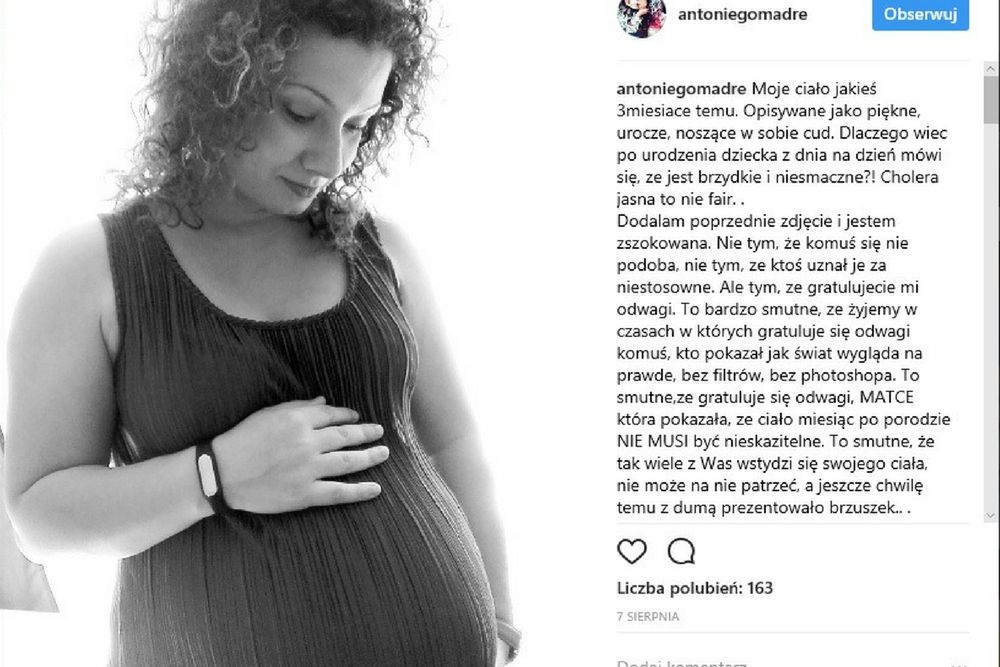 Patrycja nie wstydzi się rozstępów na brzuchu po ciąży