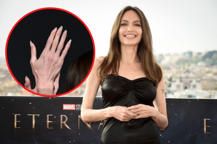 Angelina Jolie jest nieuleczalnie chora? Jej dłonie mają wskazywać na "chorobę królów"