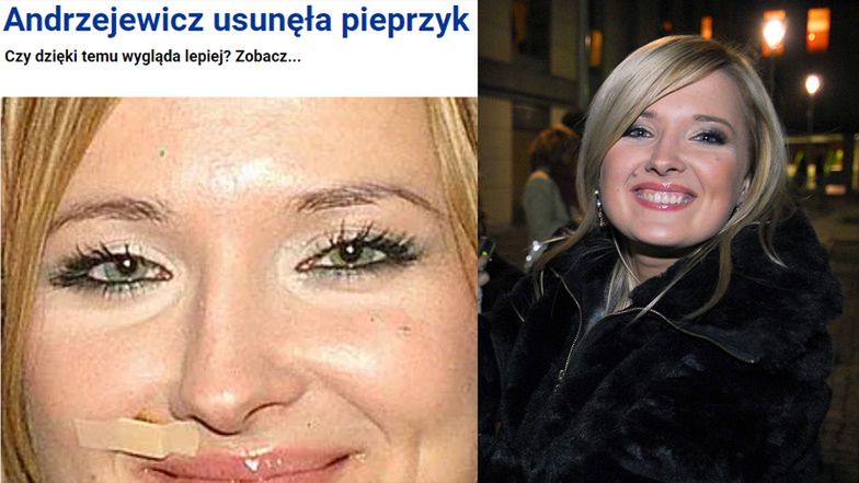 Gosia Andrzejewicz usunęła pieprzyk