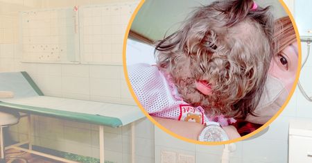 Tiktokerka poszła do szpitala. Spotkała dziecko z "syndromem wilkołaka"
