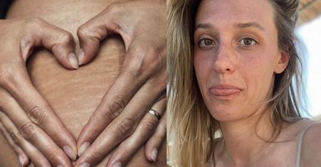 Aleksandra Żebrowska pokazała rozstępy. "Ciało bogini za nic się nie wini" (FOTO)