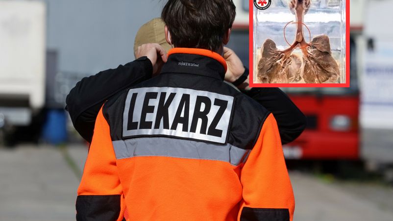 Zadławienie to stan nagły, w którym ciało obce blokuje drogi oddechowe dziecka