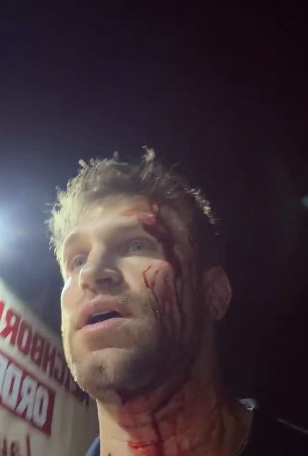Keegan Allen