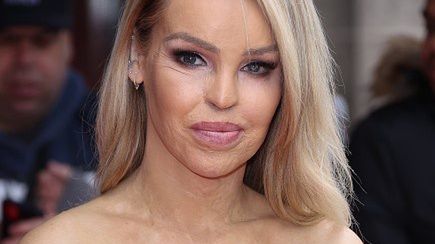 Katie Piper.