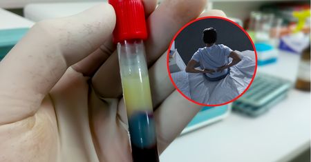 Zatkane tętnice nie bolą. Ten objaw pojawia się 5 lat przed diagnozą