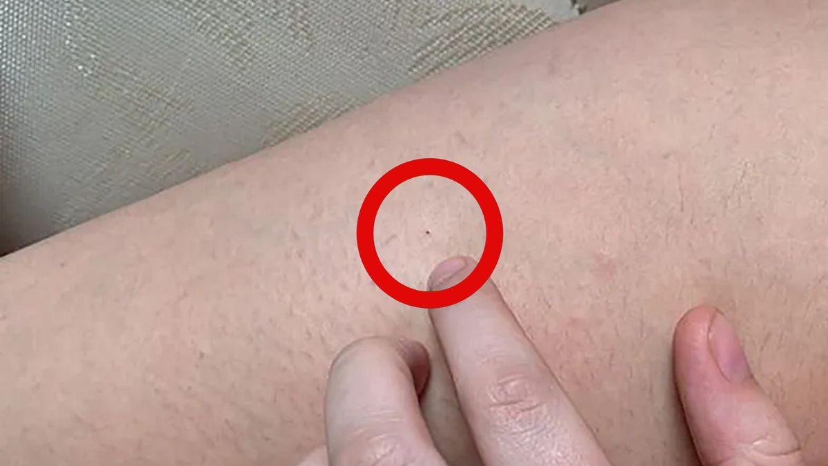 Nastolatki w klubach mają być odurzane narkotykami przy pomocy igły 