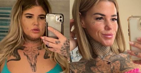 Brytyjka zrzuciła 90 kilogramów i przeszła 13 operacji w Turcji. Teraz chwali się efektami metamorfozy (FOTO)