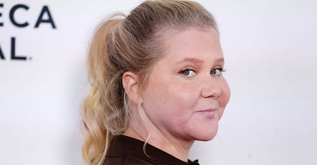 Amy Schumer schudła 23 kilogramy. Zmagała się z poważnym problemem