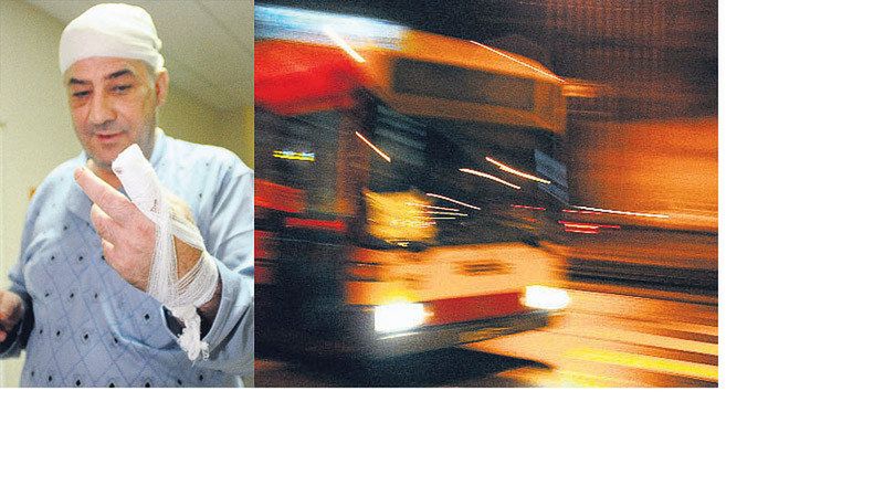 55-letni poraniony pasażer Sławomir Zalewski trafił do szpitala im. WAM, gdzie lekarze amputowali mu palec. Sprawcy napadu, w wieku ok. 35 lat, poszukuje łódzka policja.