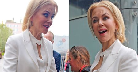 Nicole Kidman wygląda już jak Michael Jackson?
