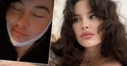 Ola Żuraw z "Top Model" przeszła rozległą operację. "Ledwo żyję, wyłam z bólu". Opisała w jakim jest stanie i pokazała zdjęcia