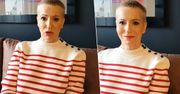 "Pie***nęło jej w głowę". Paulina Smaszcz nie przebiera w słowach i rozprawia się krzywdzącymi opiniami. Opisała, jak zachowują się Polacy