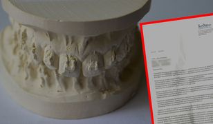 Najnowsze ustalenia ws. "ortodonty" z Torunia. Wirtualna Polska dotarła do dokumentów ubezpieczyciela